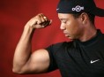 imagen Tiger Woods y su nuevo problema de consumo de esteroides
